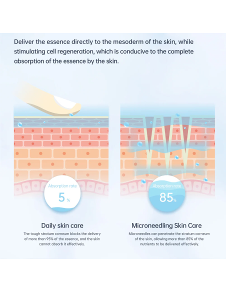 Dr. Pen Mikroneulauslaite Dermapen A11 Ultima PRO, paristolla