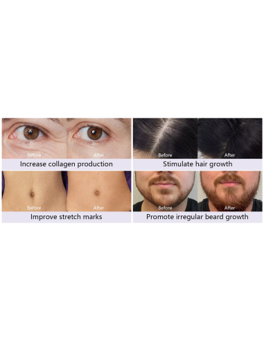 Dr. Pen Mikroneulauslaite Dermapen...