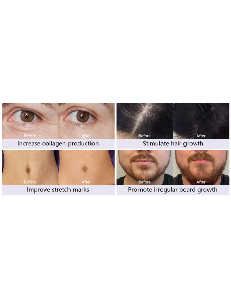 Dr. Pen Mikroneulauslaite Dermapen A10, akkukäyttöinen