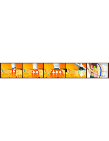 Kosmetologin laite, jossa on 4 toimintoa - kavitaatio, 3D-radiotaajuus, IR-biofotoni, tyhjiö