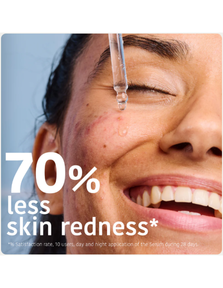 IROHA NATURE ACNE PRONE -seerumi salisyylihapolla aknearville, silottaa ihoa 30ml