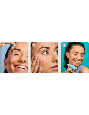 IROHA NATURE ACNE PRONE -seerumi...