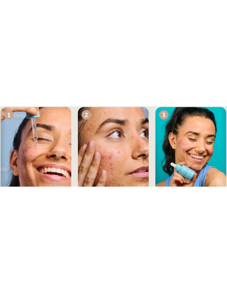 IROHA NATURE ACNE PRONE -seerumi salisyylihapolla aknearville, silottaa ihoa 30ml